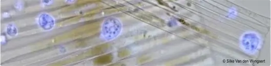 Microscopic photo of aquatic parasites - a beige background with purple spherical clusters