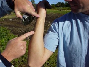 Close up of photo of someone pointing to a scar on his arm that was received in a farm work related accident