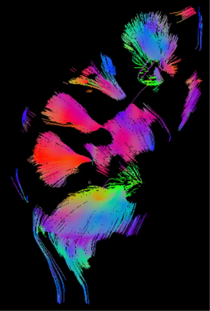 Parenchima - Imaging chronic kidney disease - kidney art