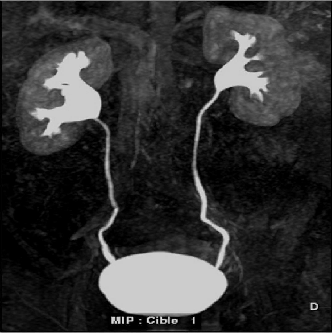 Imaging chronic kidney disease with PARENCHIMA
